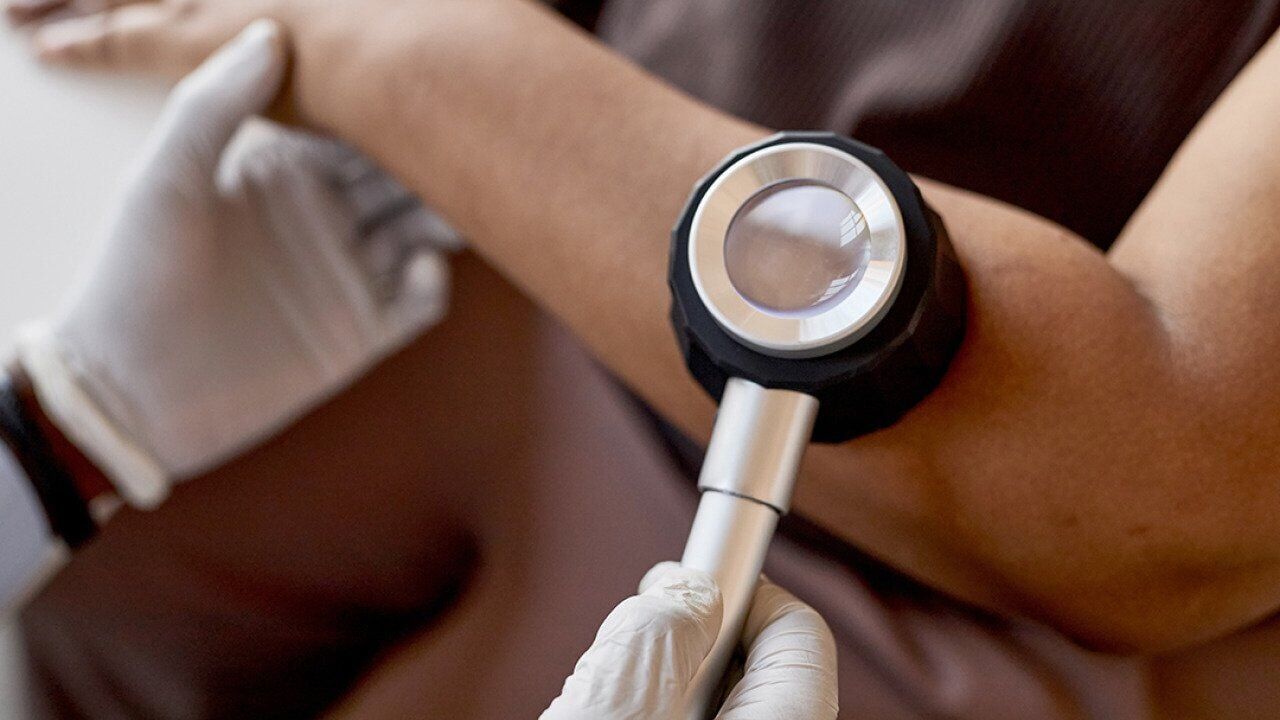 Fear is keeping people from cancer screenings — and that could cost lives